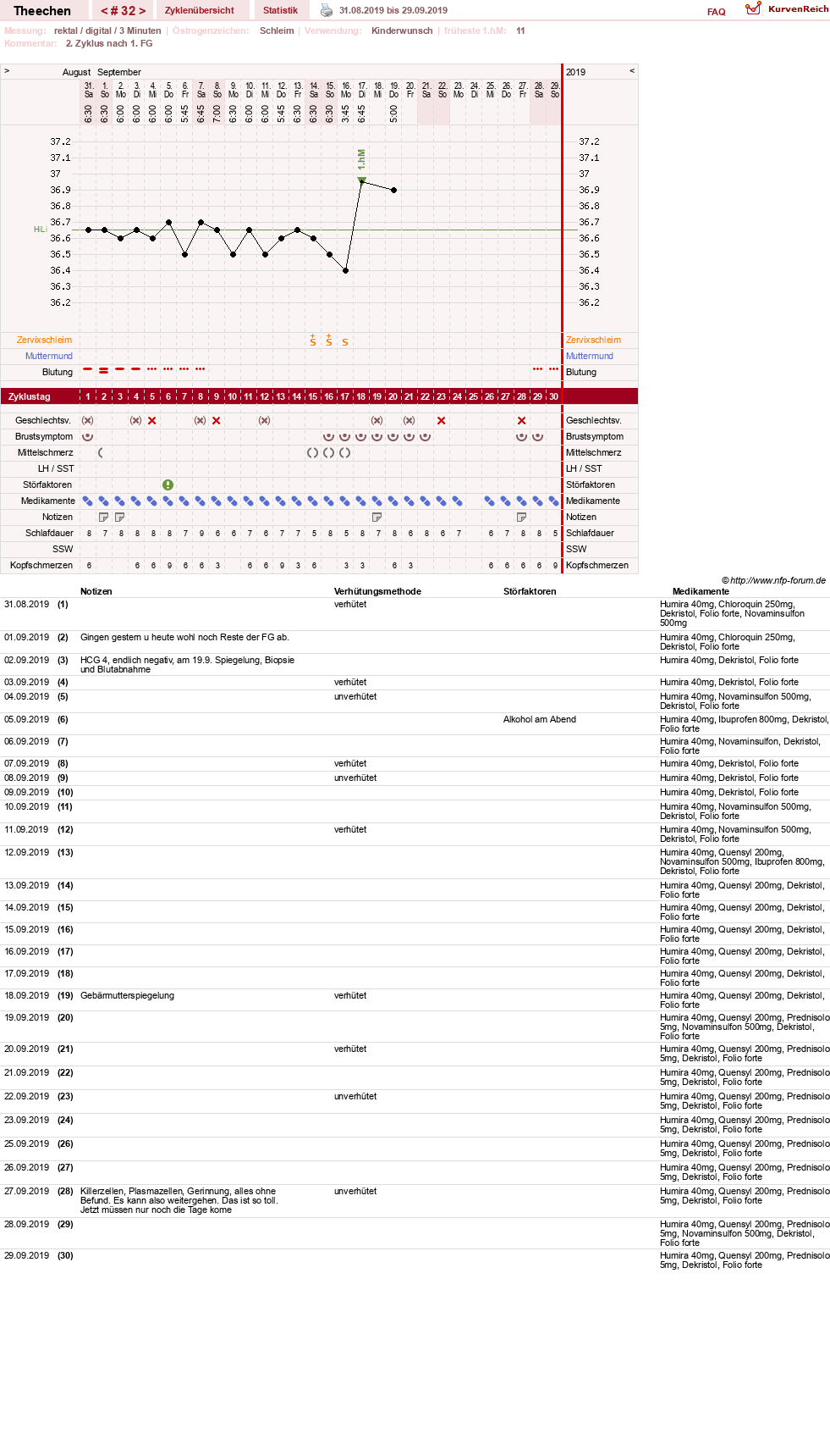 NFP-Kurve User #31018