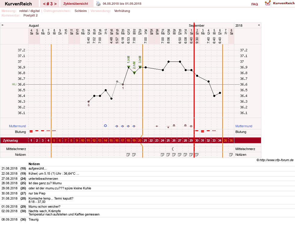 NFP-Kurve User #31021