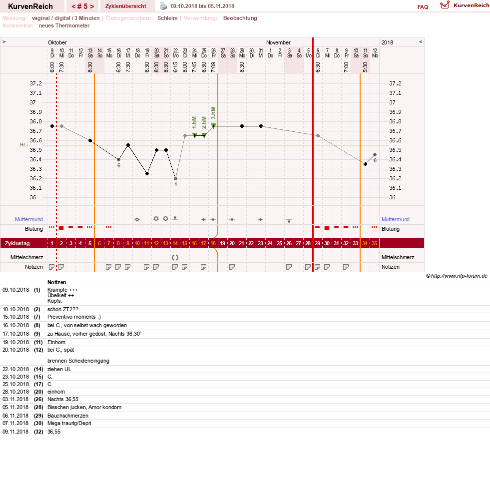 NFP-Kurve User #31021