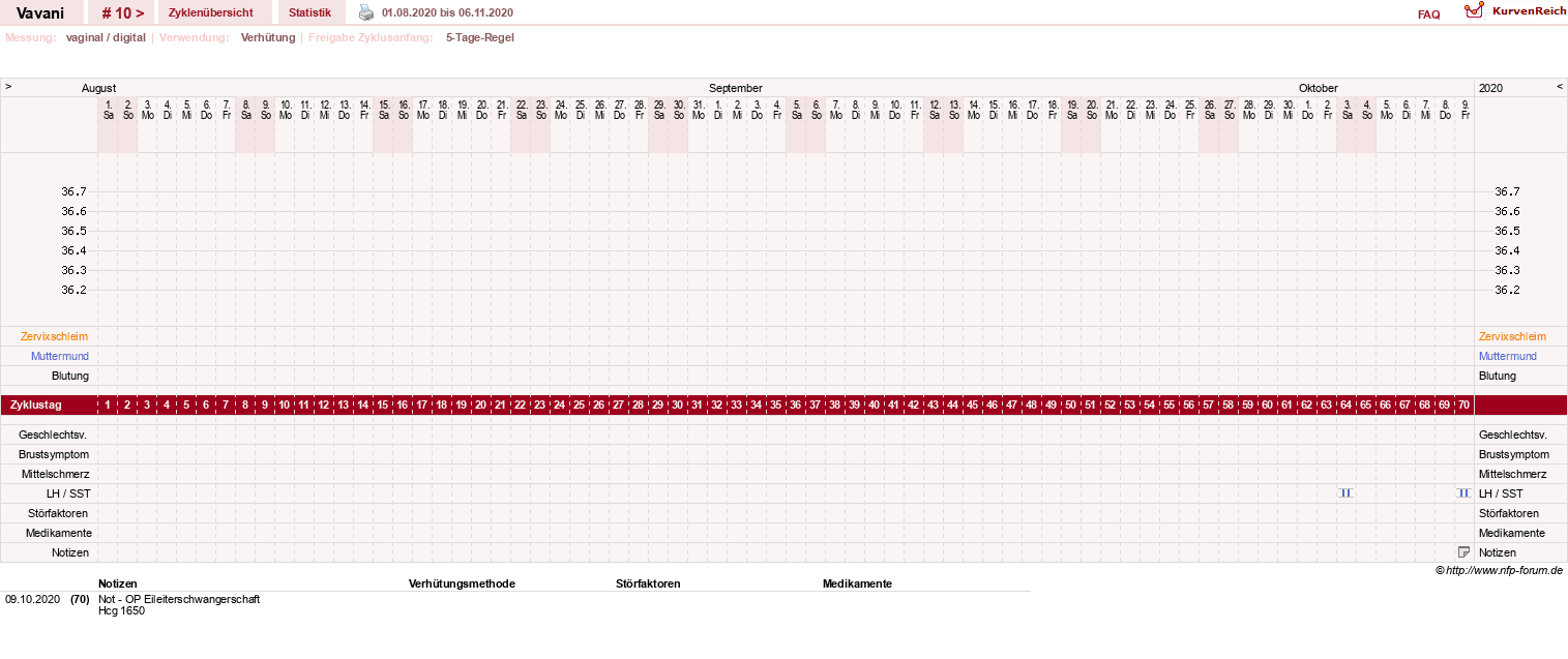 NFP-Kurve User #31243