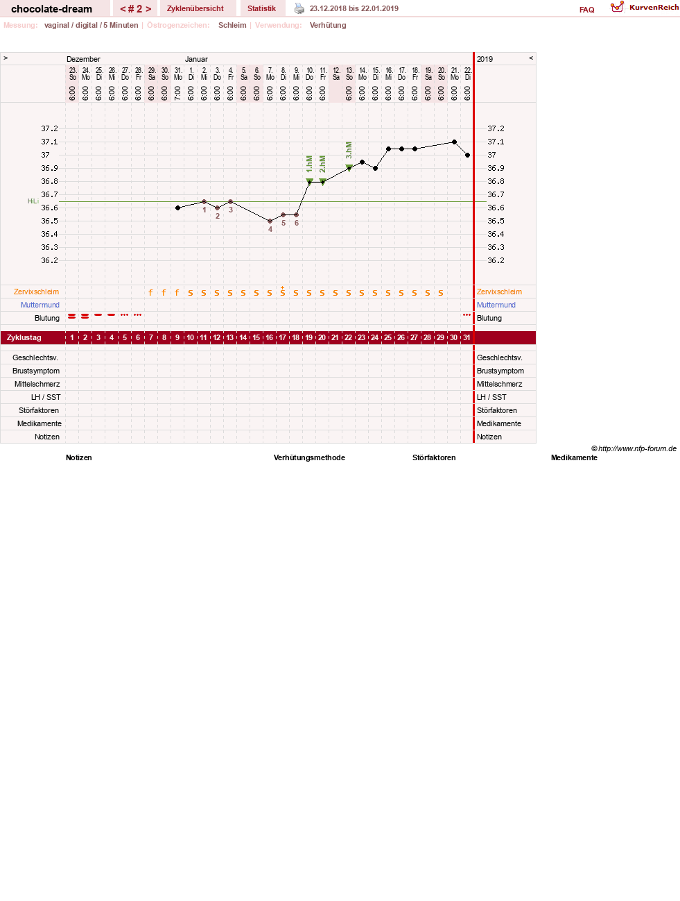 NFP-Kurve User #31288