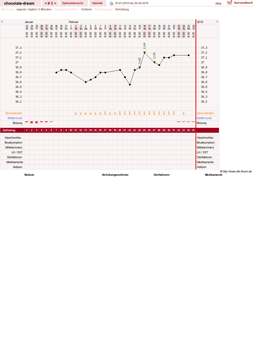 NFP-Kurve User #31288