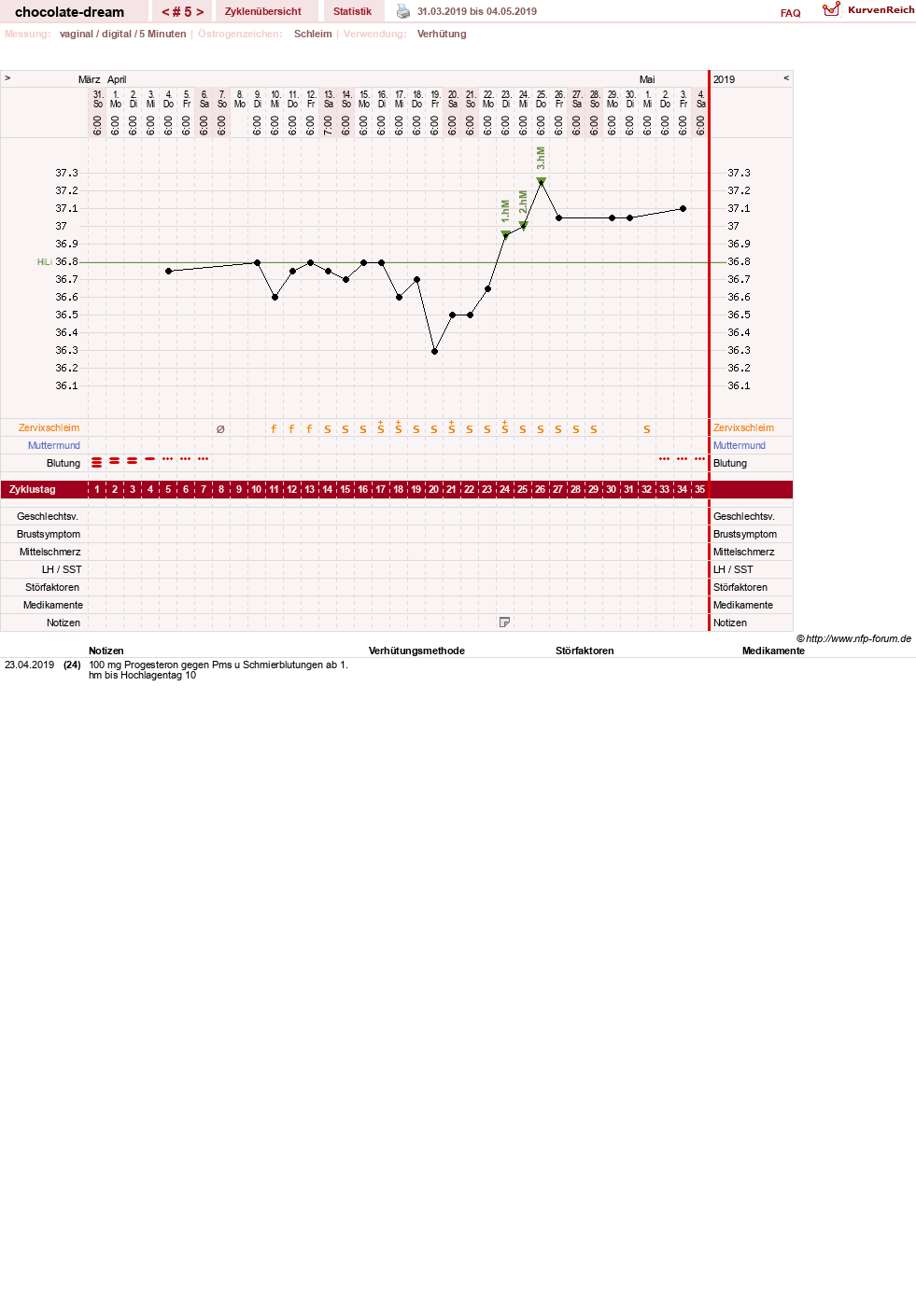 NFP-Kurve User #31288