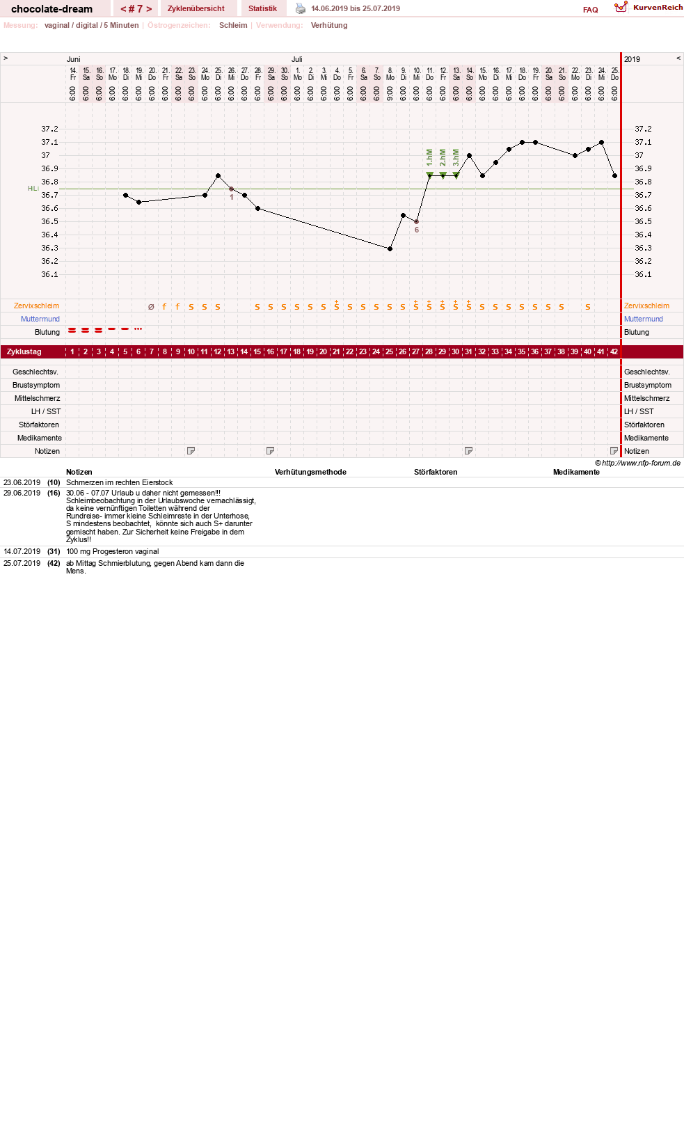 NFP-Kurve User #31288