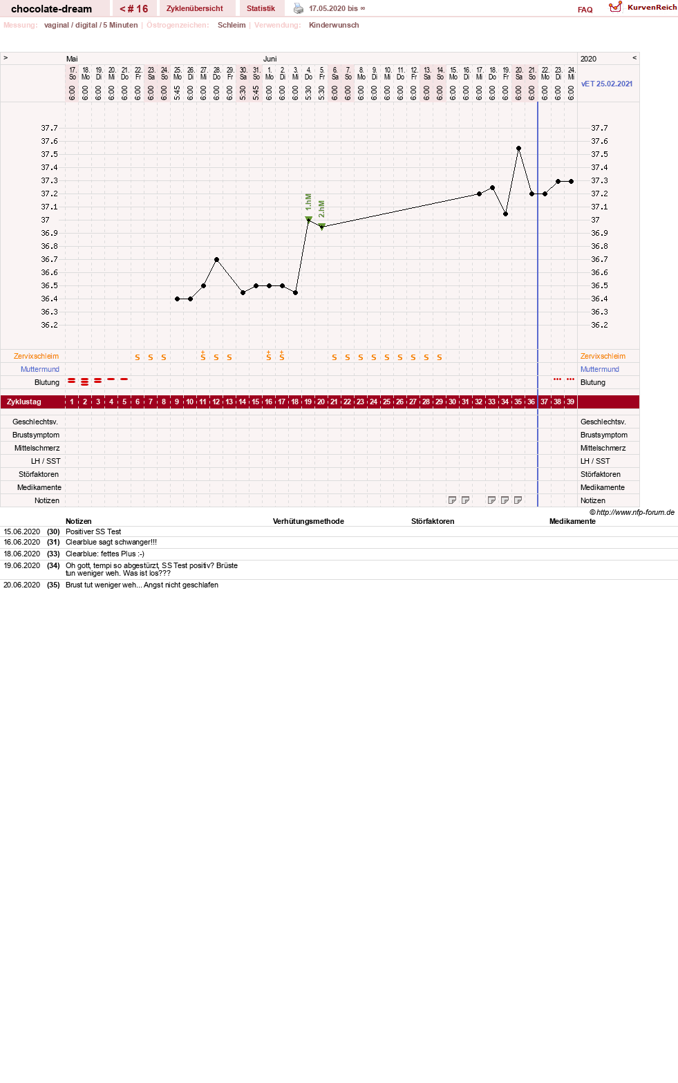 NFP-Kurve User #31288