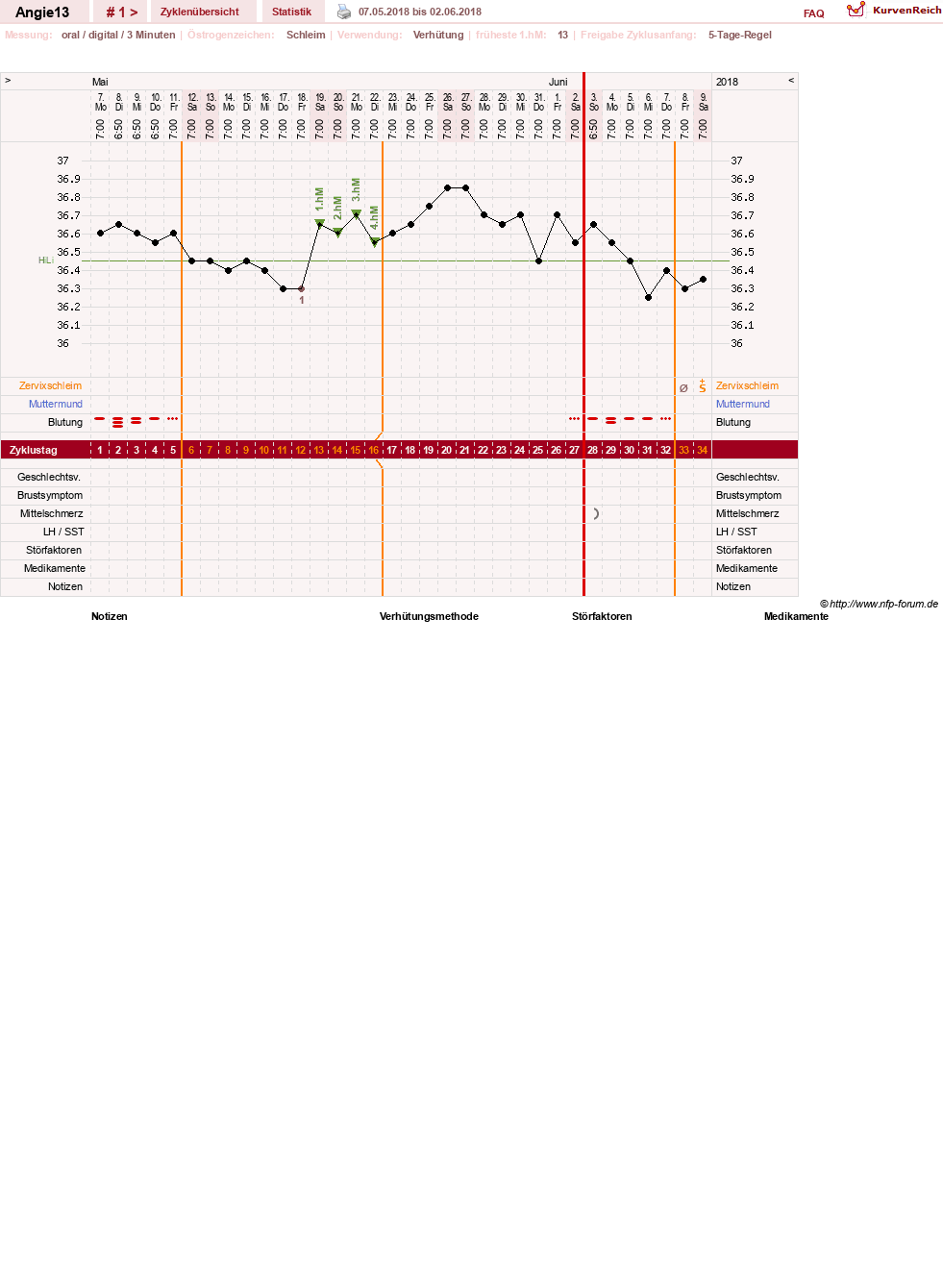 NFP-Kurve User #31343
