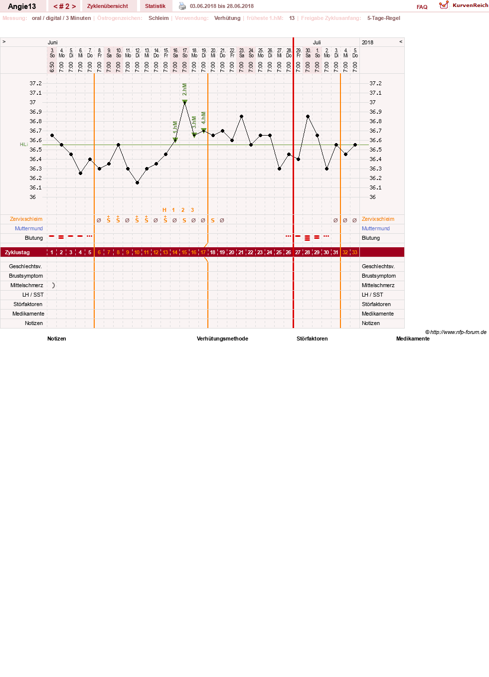 NFP-Kurve User #31343