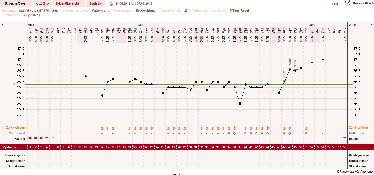 NFP-Kurve User #31626