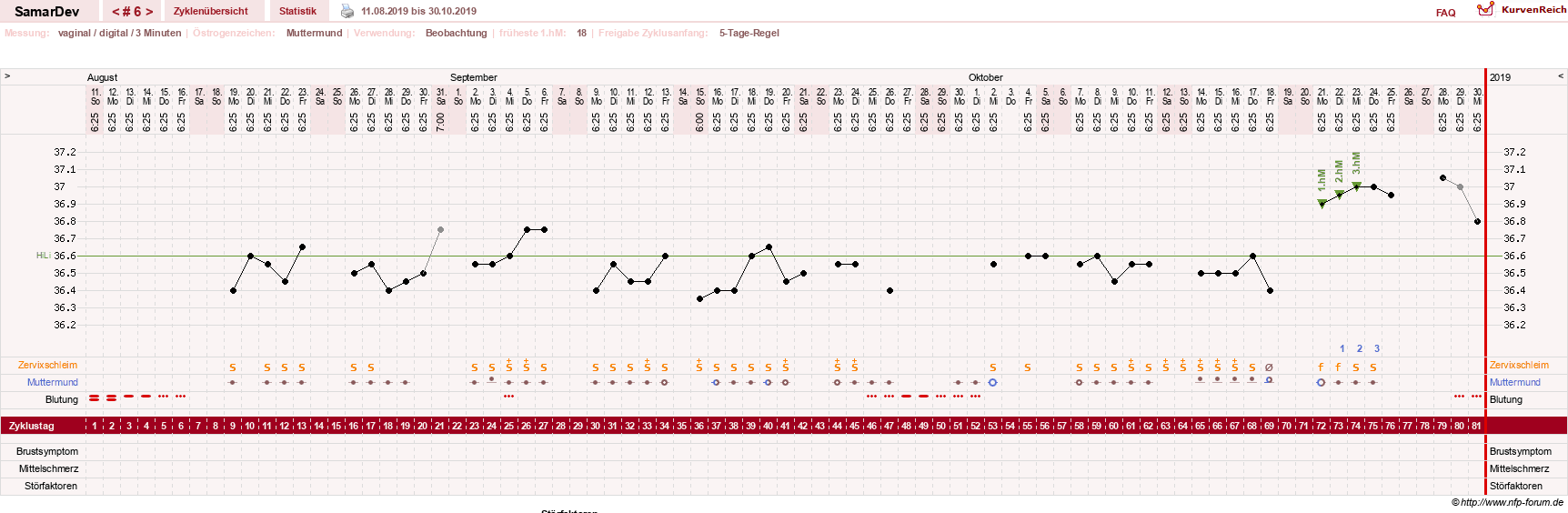 NFP-Kurve User #31626