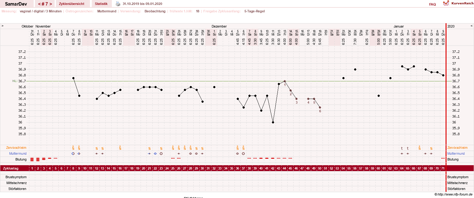 NFP-Kurve User #31626