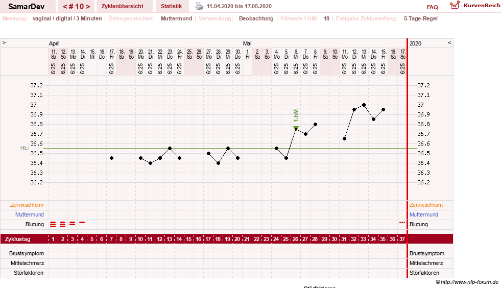 NFP-Kurve User #31626