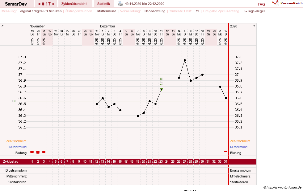NFP-Kurve User #31626