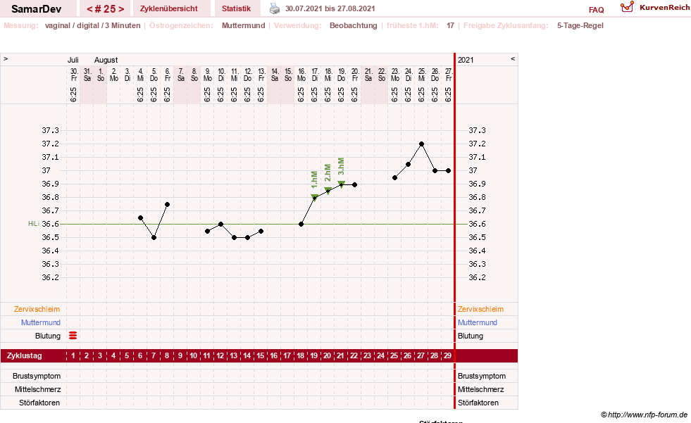 NFP-Kurve User #31626