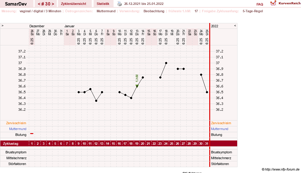 NFP-Kurve User #31626