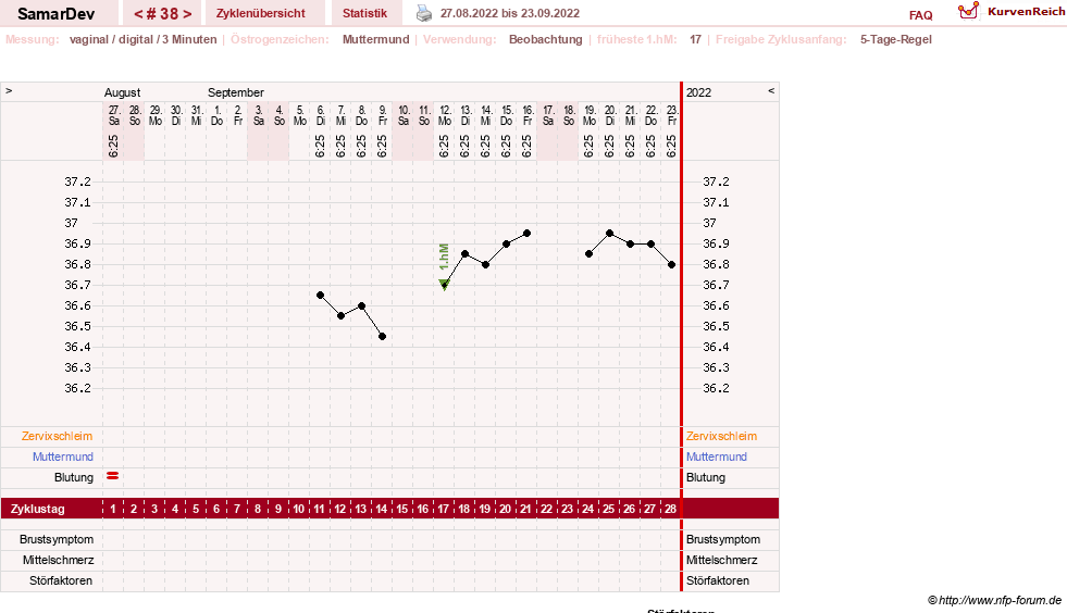 NFP-Kurve User #31626