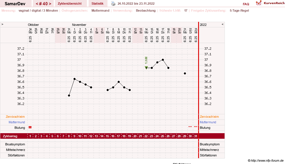 NFP-Kurve User #31626