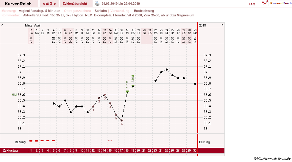 NFP-Kurve User #31652