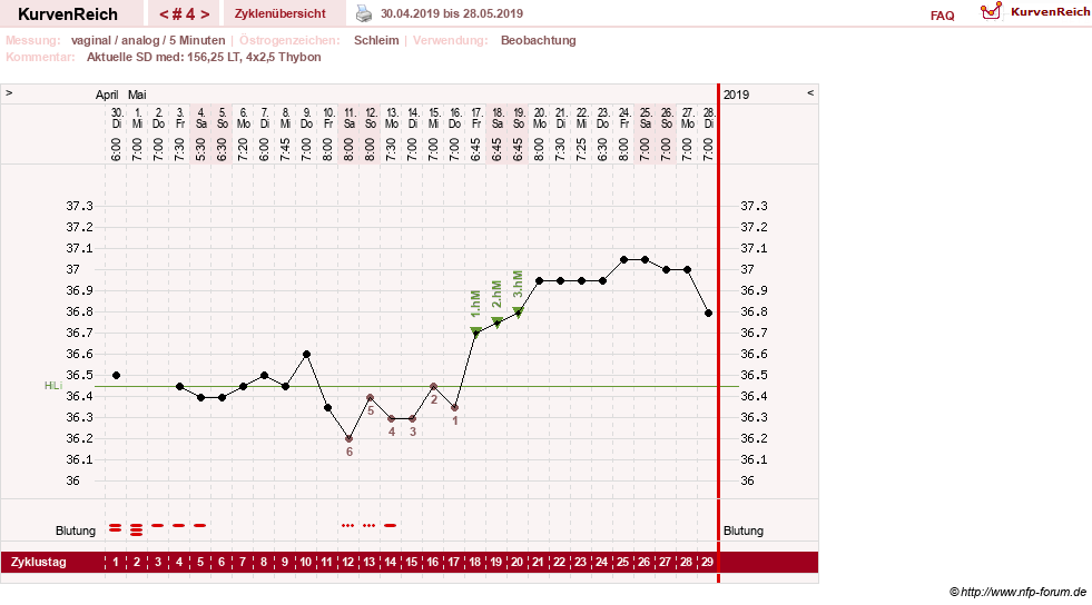 NFP-Kurve User #31652