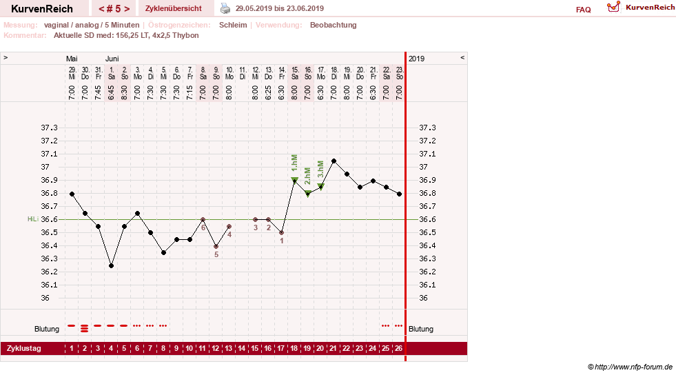NFP-Kurve User #31652