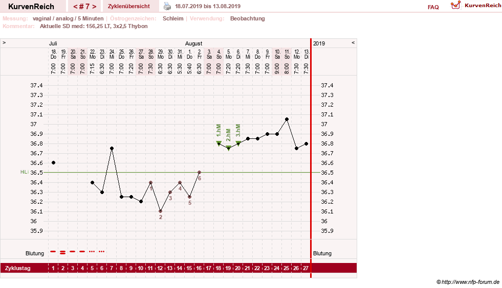 NFP-Kurve User #31652
