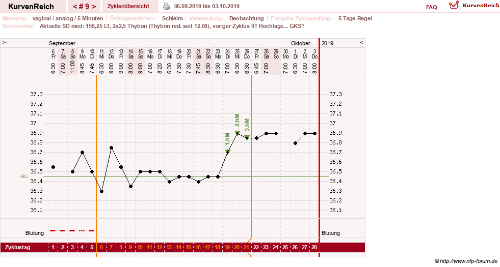 NFP-Kurve User #31652