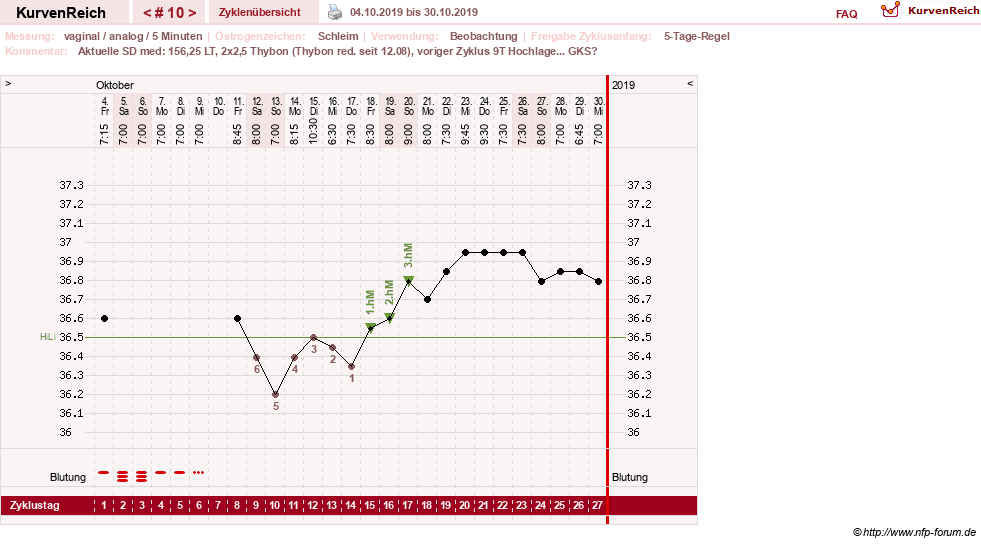 NFP-Kurve User #31652
