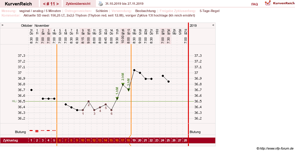 NFP-Kurve User #31652