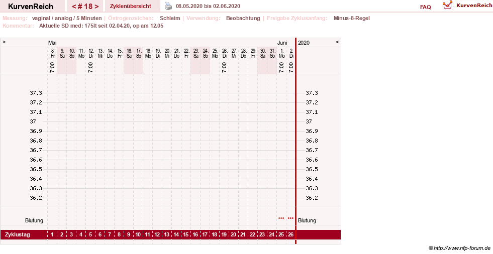 NFP-Kurve User #31652