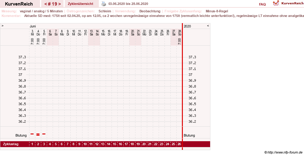 NFP-Kurve User #31652