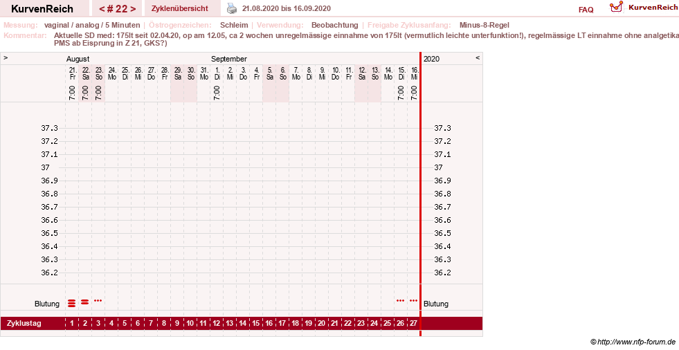 NFP-Kurve User #31652