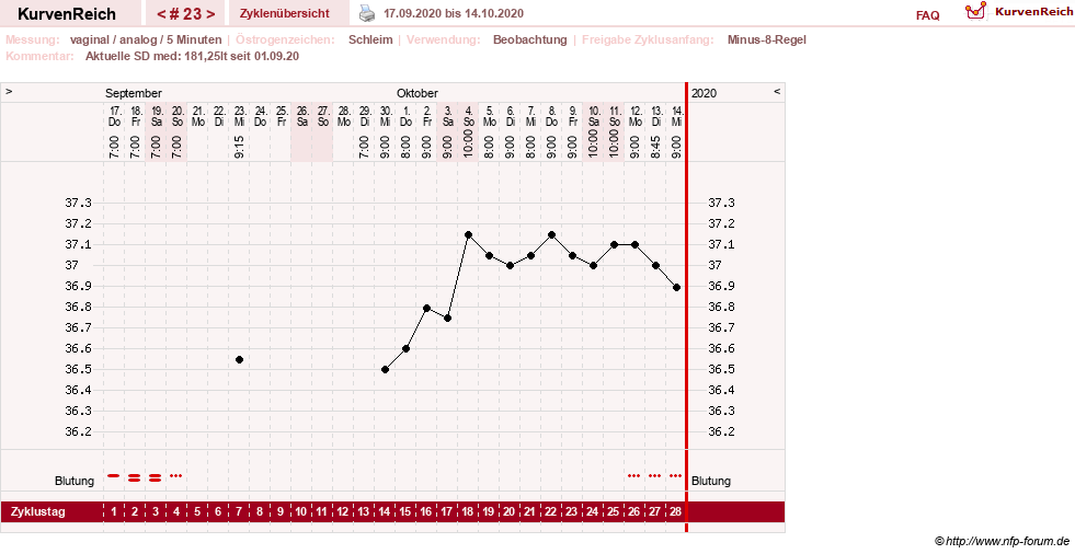 NFP-Kurve User #31652