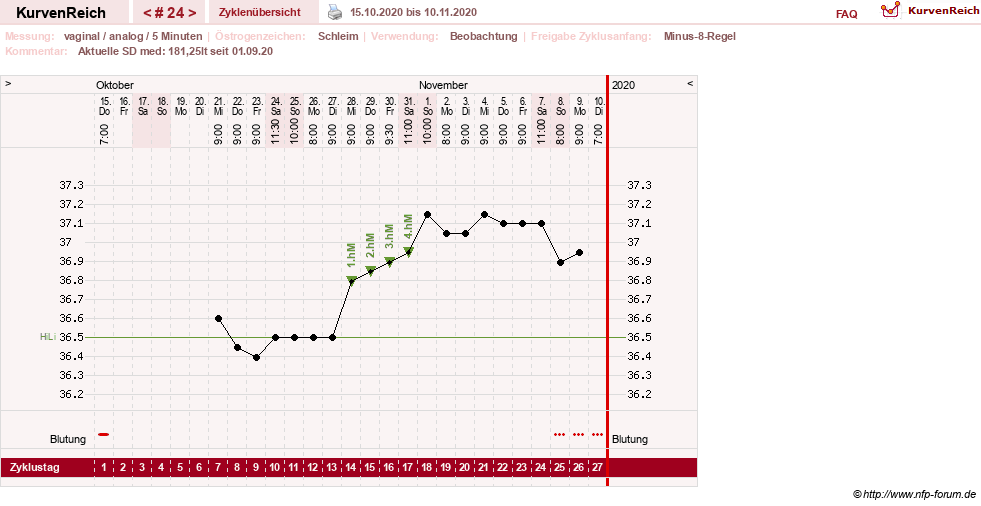 NFP-Kurve User #31652