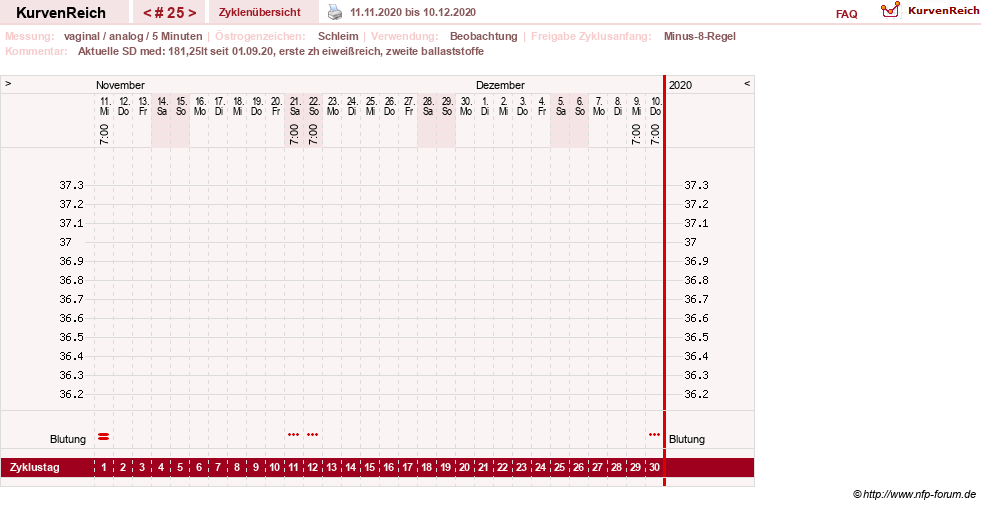 NFP-Kurve User #31652