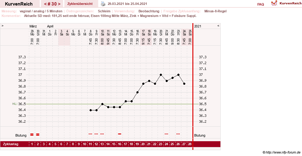 NFP-Kurve User #31652
