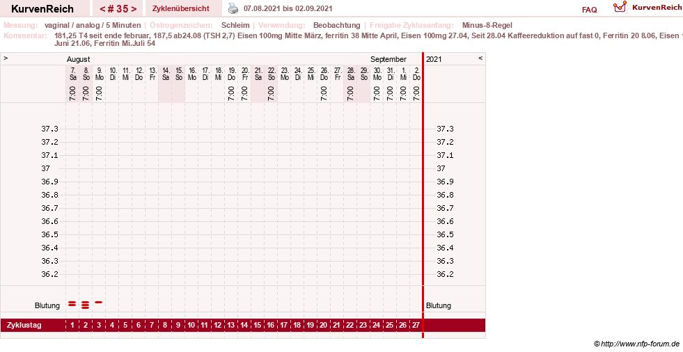 NFP-Kurve User #31652