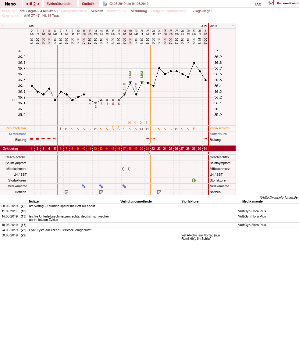 NFP-Kurve User #31761