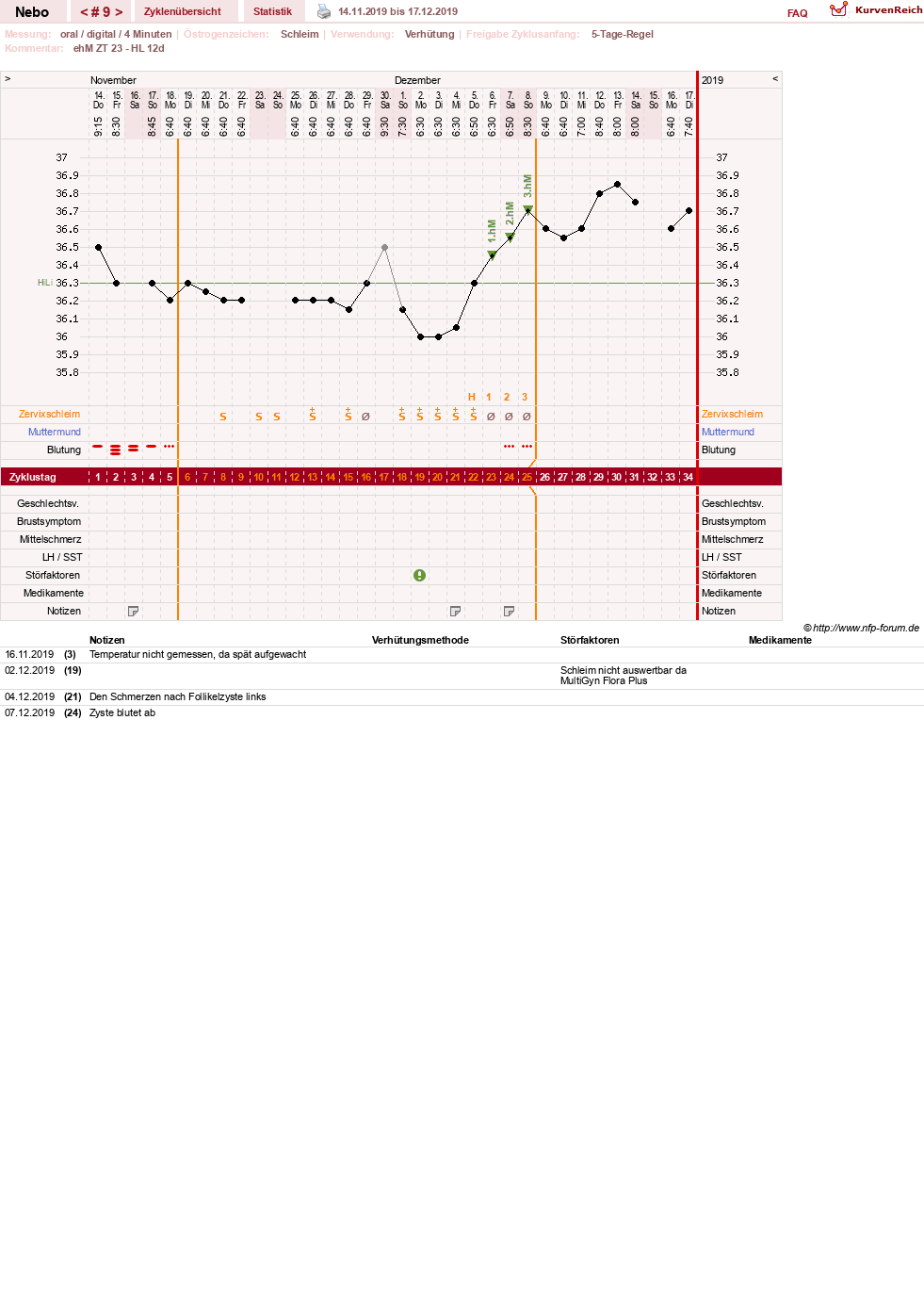 NFP-Kurve User #31761