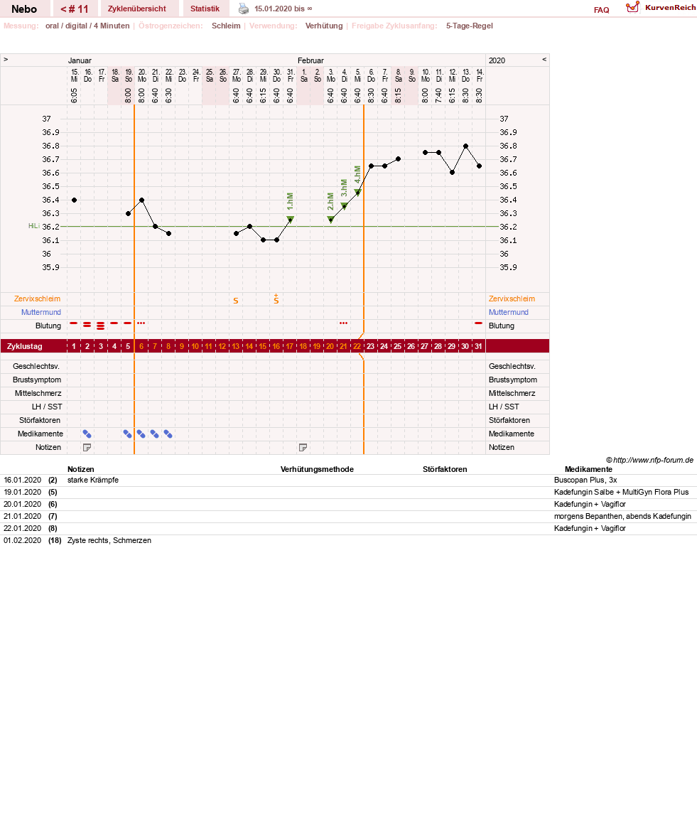NFP-Kurve User #31761