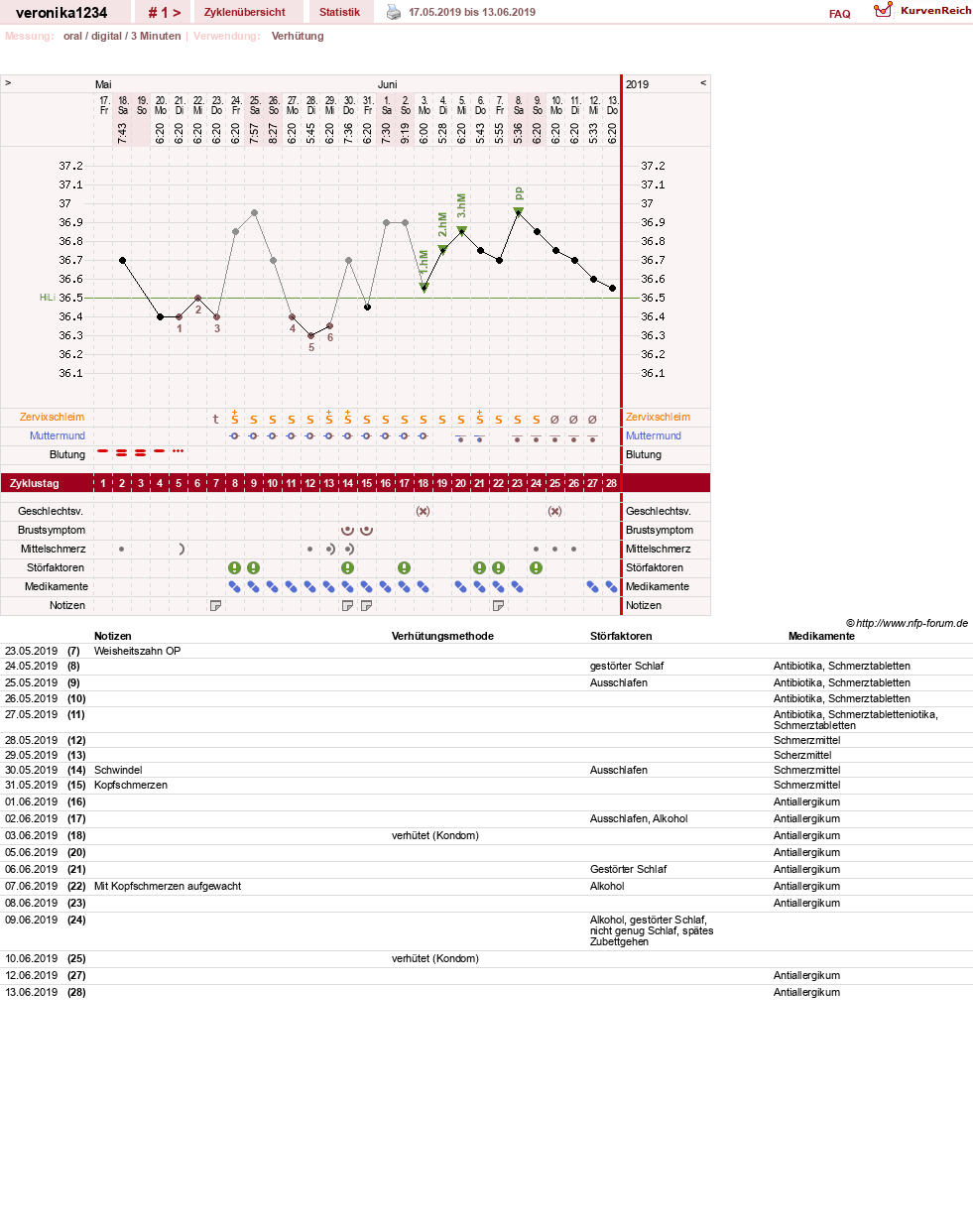 NFP-Kurve User #31861