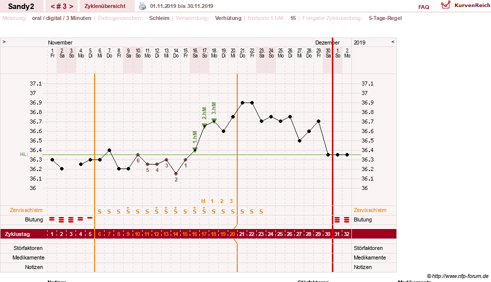 NFP-Kurve User #33654