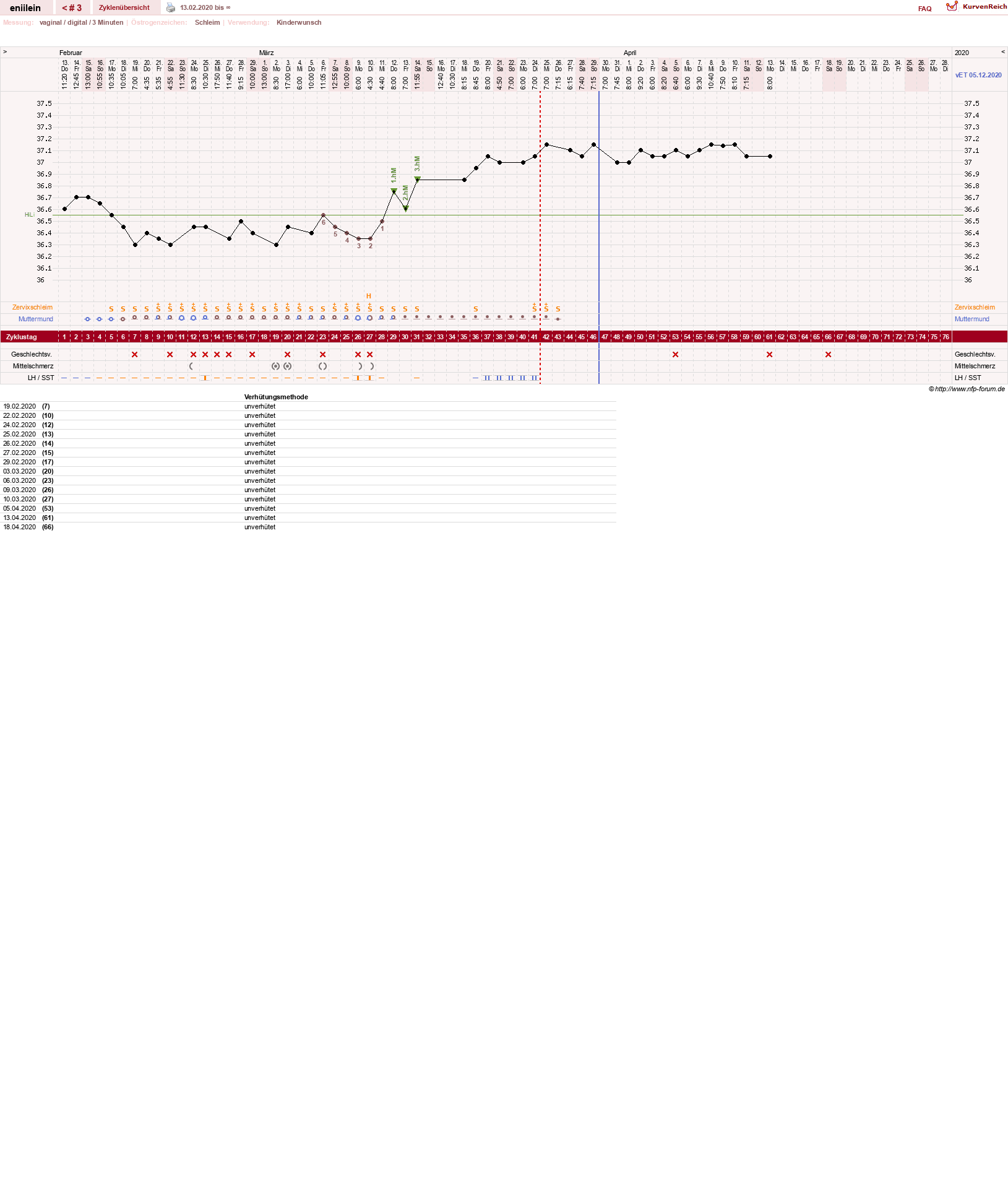 NFP-Kurve User #37780