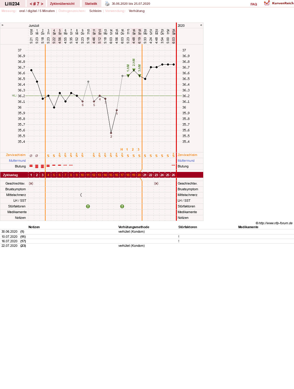 NFP-Kurve User #39818