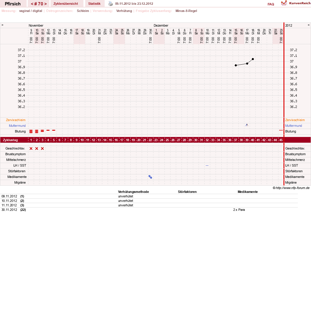 NFP-Kurve User #3983