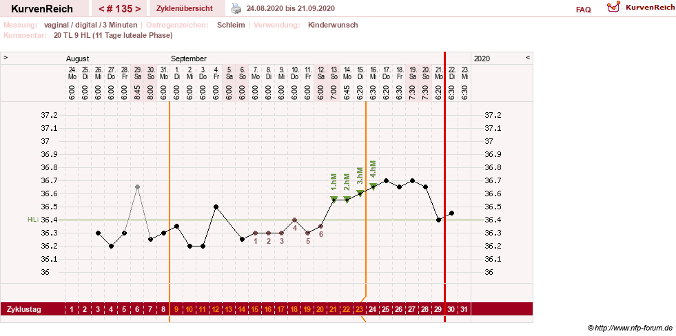 NFP-Kurve User #4346