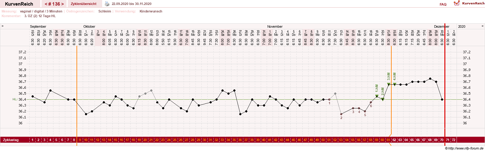 NFP-Kurve User #4346
