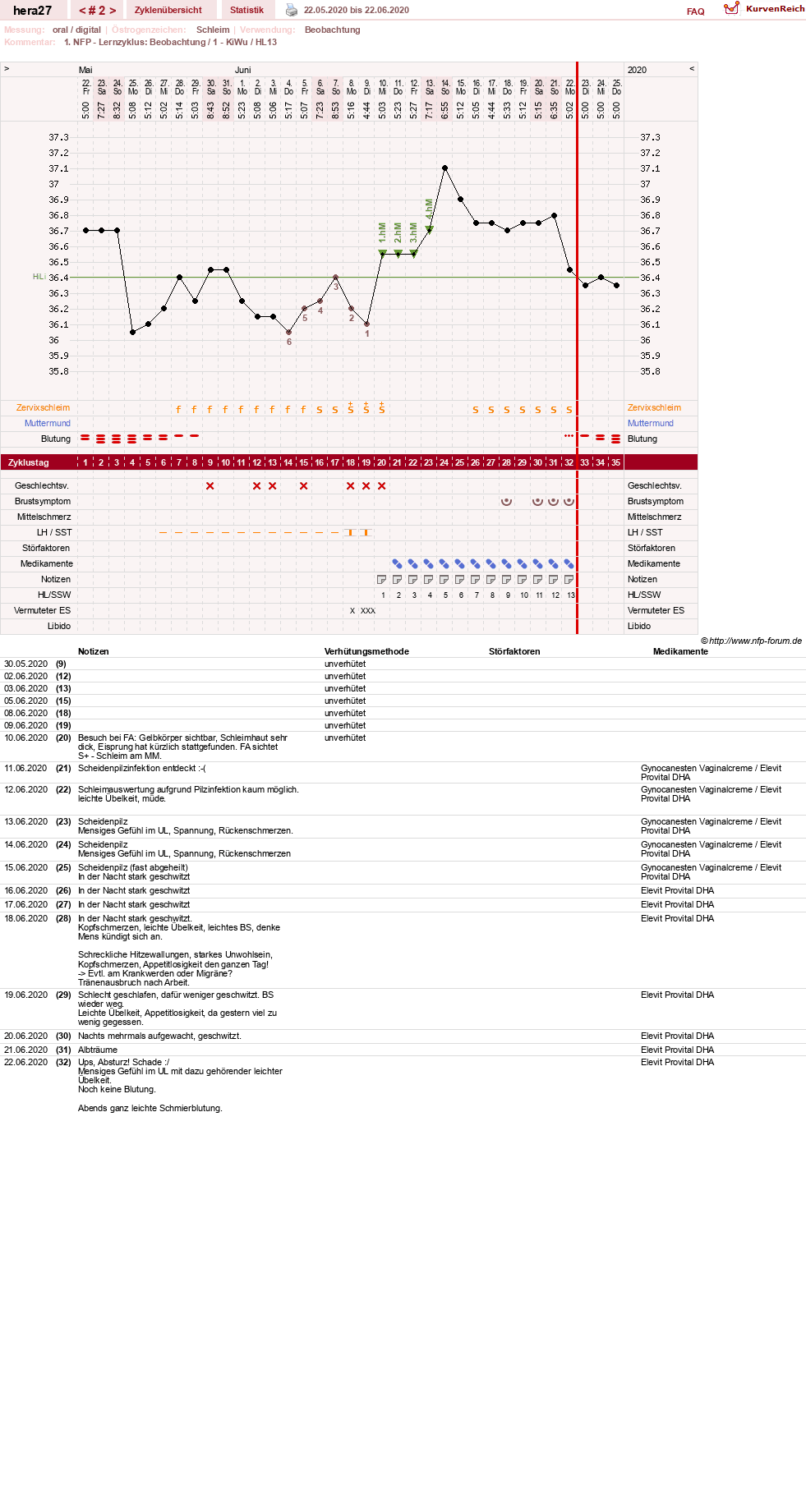 NFP-Kurve User #48117