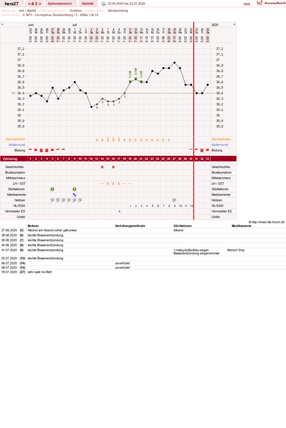 NFP-Kurve User #48117