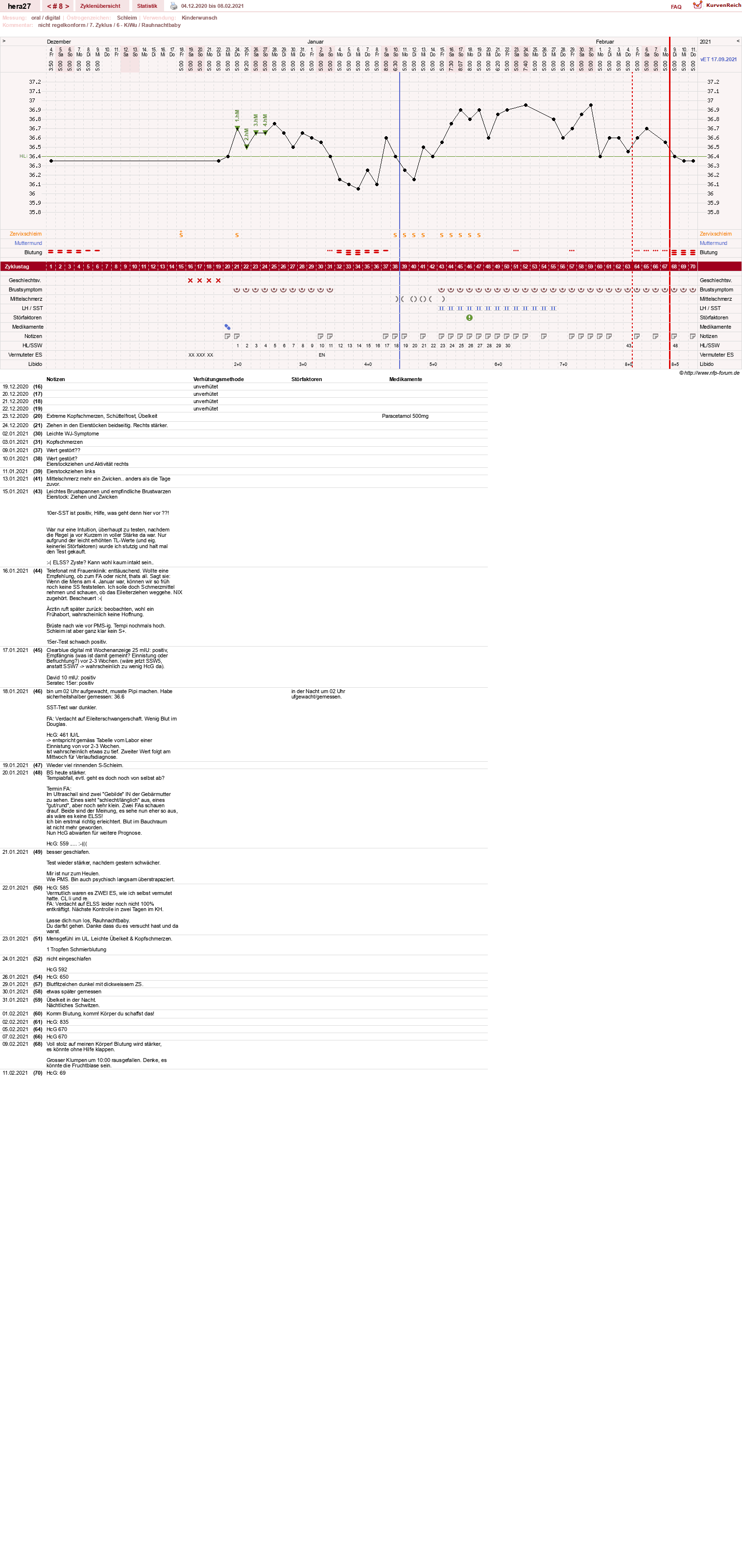 NFP-Kurve User #48117