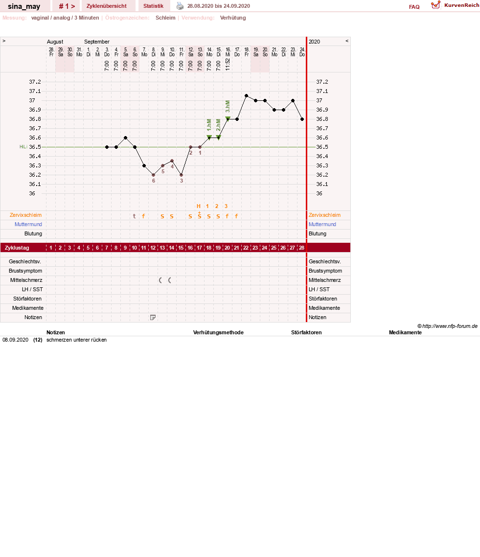 NFP-Kurve User #54631