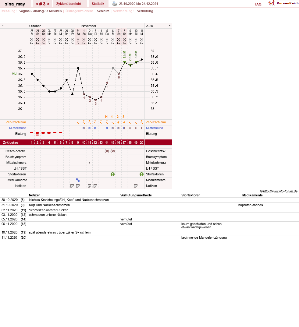 NFP-Kurve User #54631